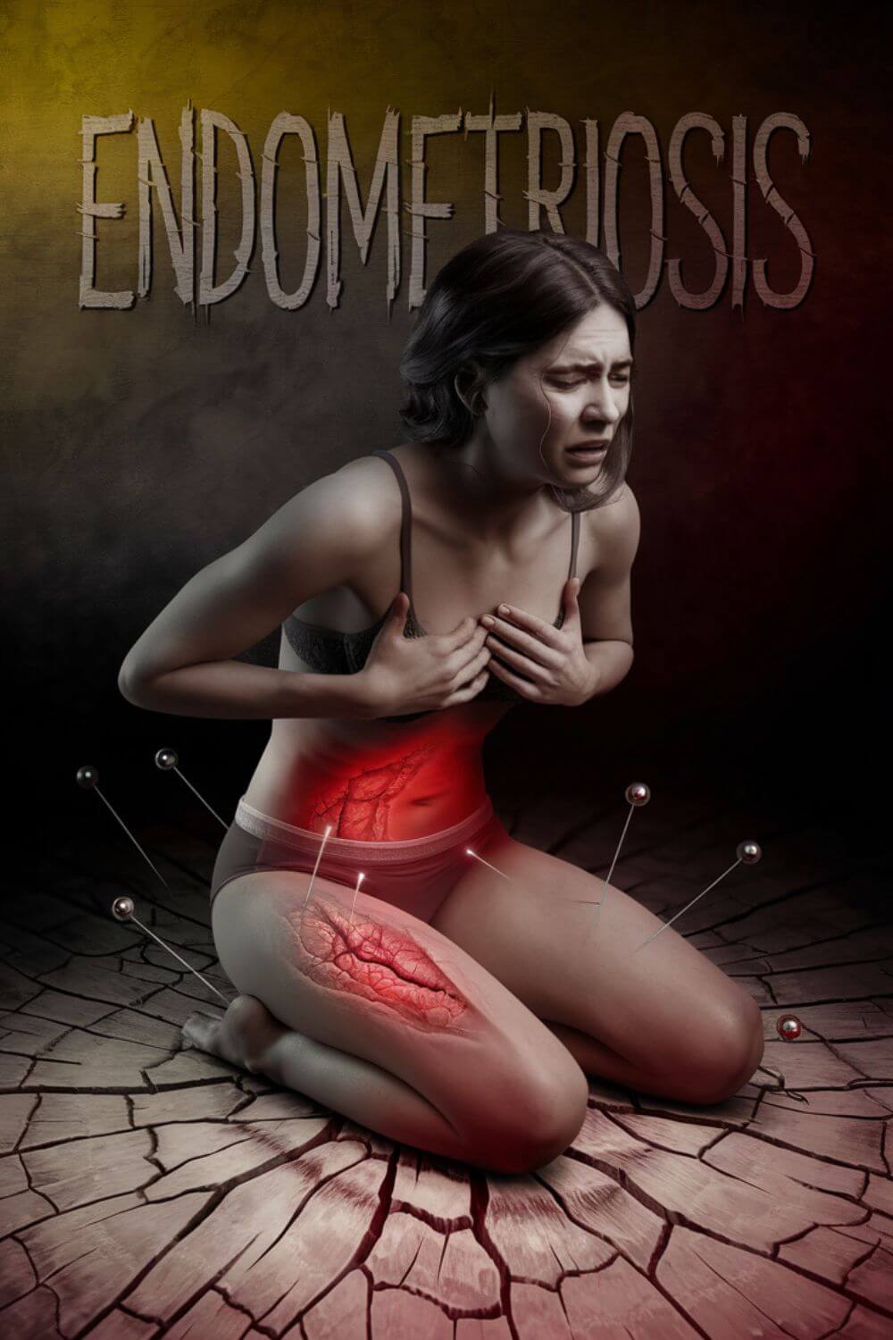 How to Explain Endometriosis Pain to a Guy 5