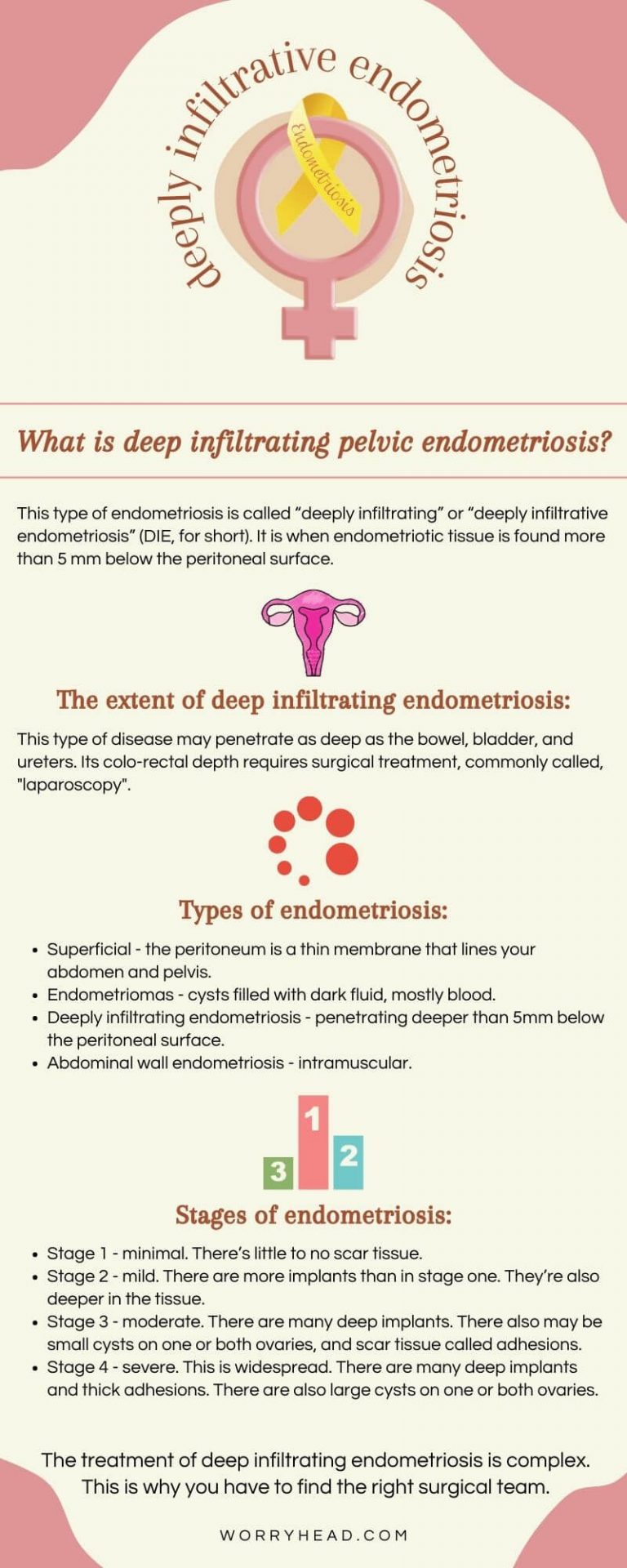 What Is Deep Infiltrating Pelvic Endometriosis Endometriosis