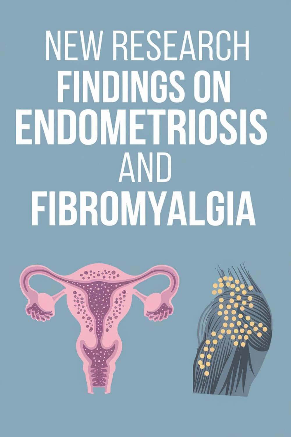 Are There Any New Research Findings on Endometriosis and Fibromyalgia 6