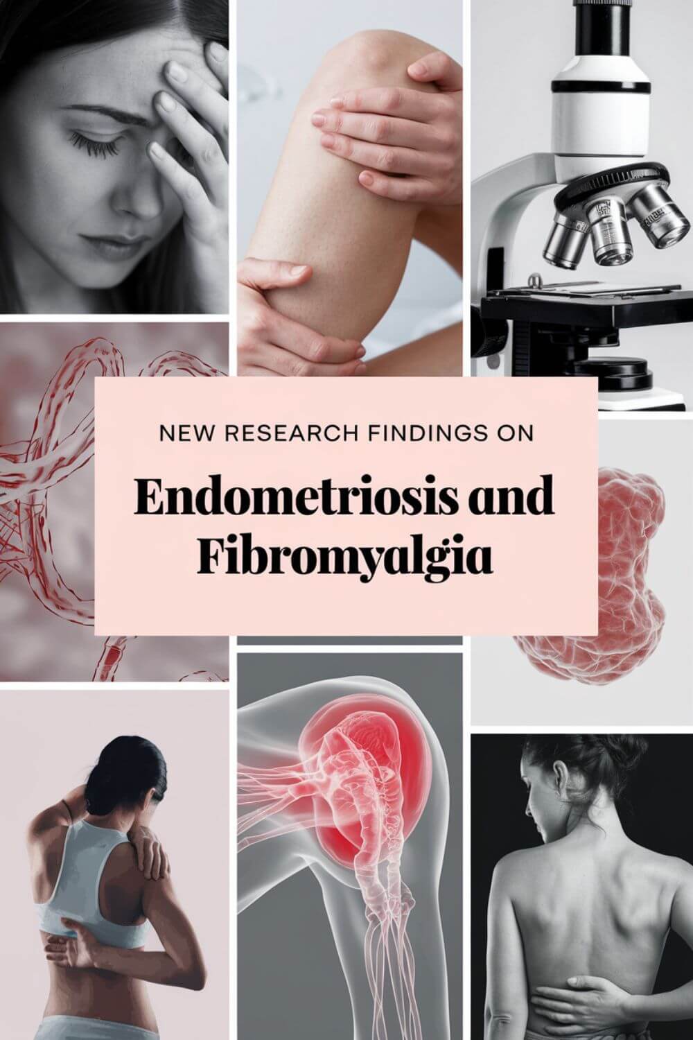 Are There Any New Research Findings on Endometriosis and Fibromyalgia 7