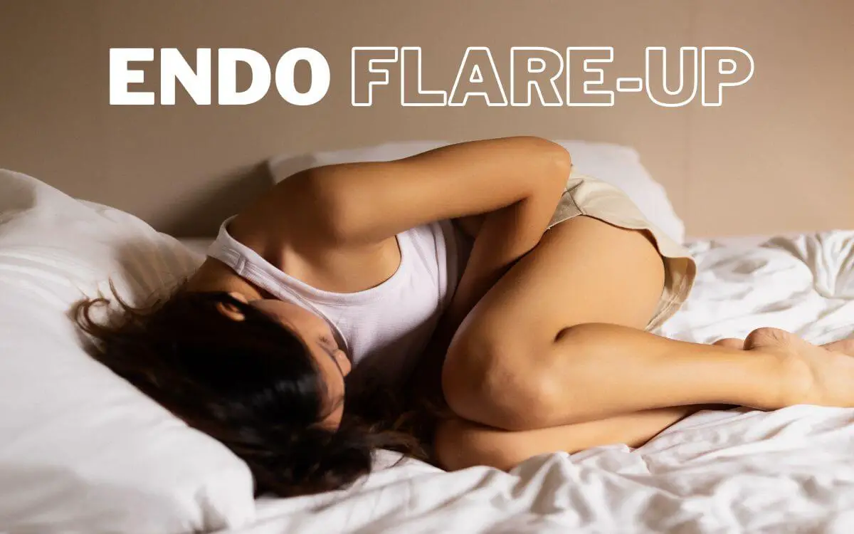 Endometriosis flare up