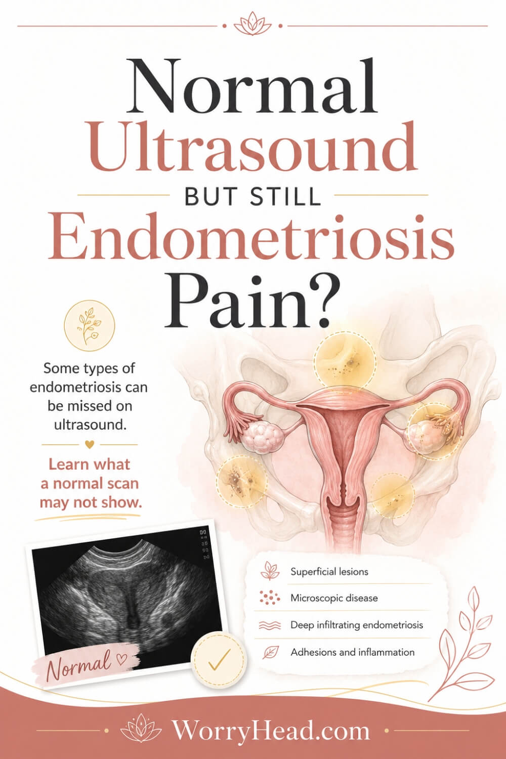 Normal Ultrasound But Still Endometriosis Pain 2