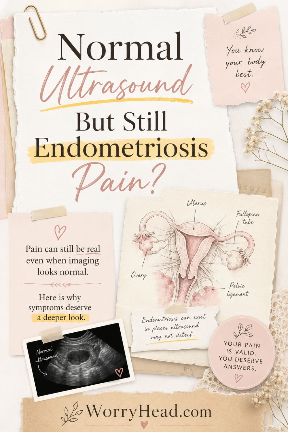 Normal Ultrasound But Still Endometriosis Pain 4