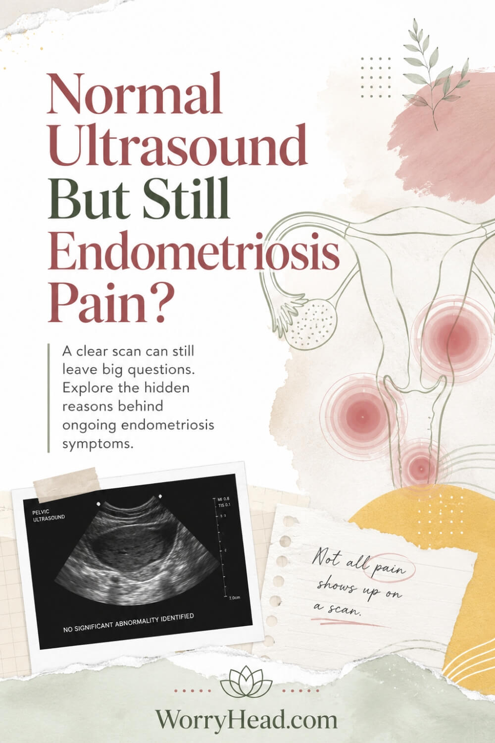 Normal Ultrasound But Still Endometriosis Pain 6